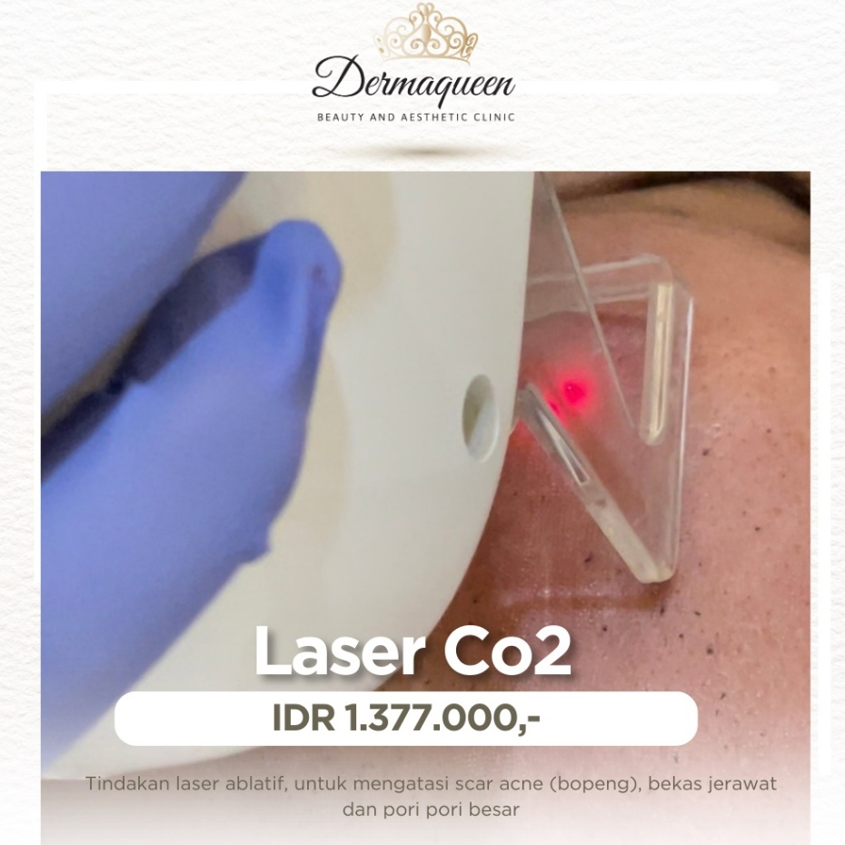 LaserCo2