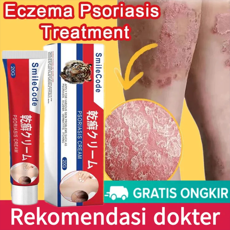 （COD）salep gatal eksim paling ampuh salep gatel salep eksim salep gatal kulit yang ampuh salep eksim