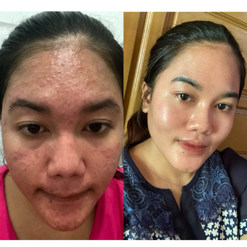 ZR Glow skincare semua jenis kulit