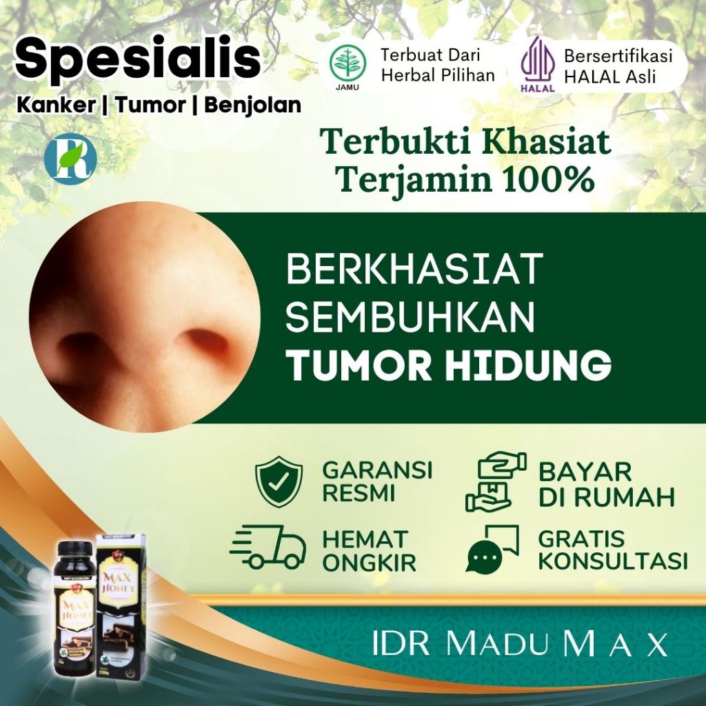 Obat Tumor Hidung  - IDR Madu Max - Testimoni Terbukti 100%