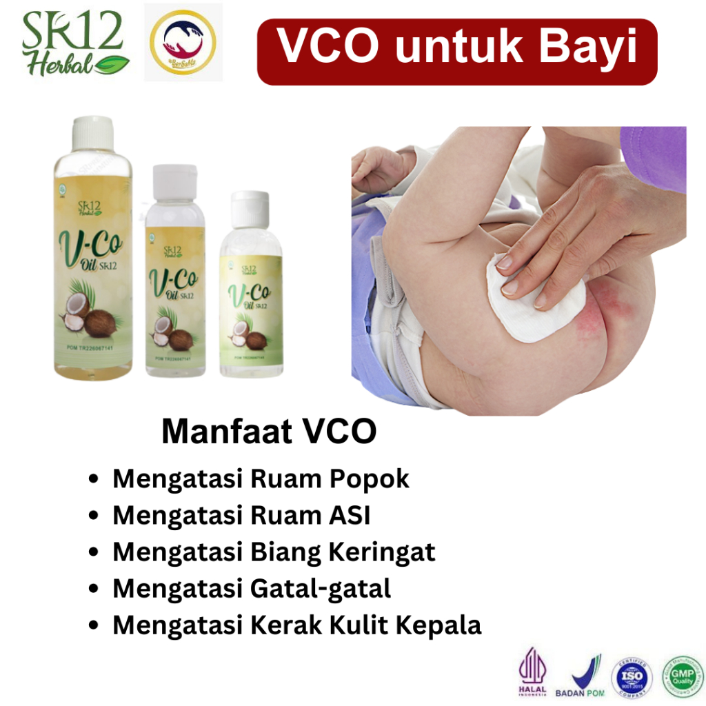 VCO Untuk Ruam Popok Minyak Kelapa Minyak Bayi Biang Keringat Untuk Kulit Bayi dan Dewasa