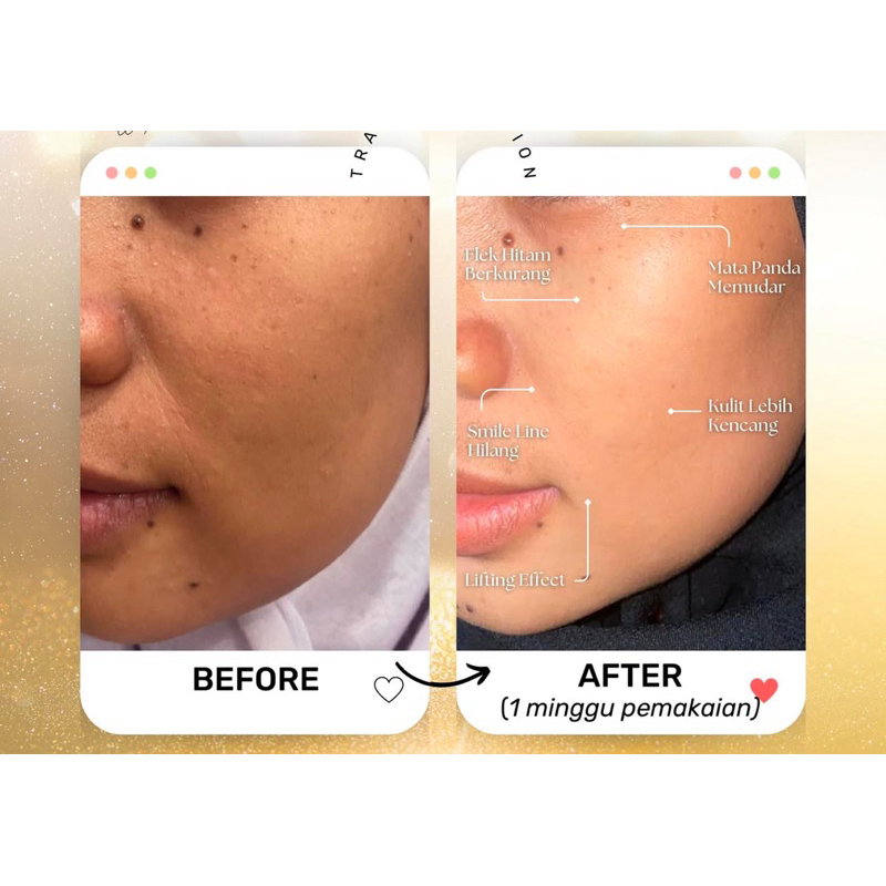 TERMURAH ECER SABUN KOJIC ACID PEMBERSIH WAJAH MUKA NOMOR BPOM ADA IZIN EDAR INDONESIA AMAN TANPA PA