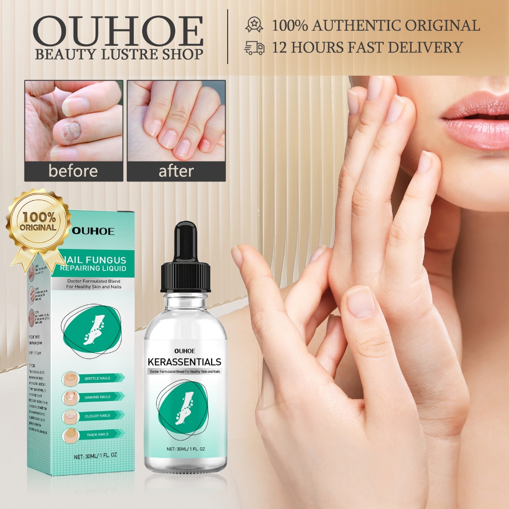 OUHOE Fungal Nail Serum 30ml Jamur Kuku Tangan Obat Jamur Kuku Obat Kuku Cantengan Jamur Kuku Rusak