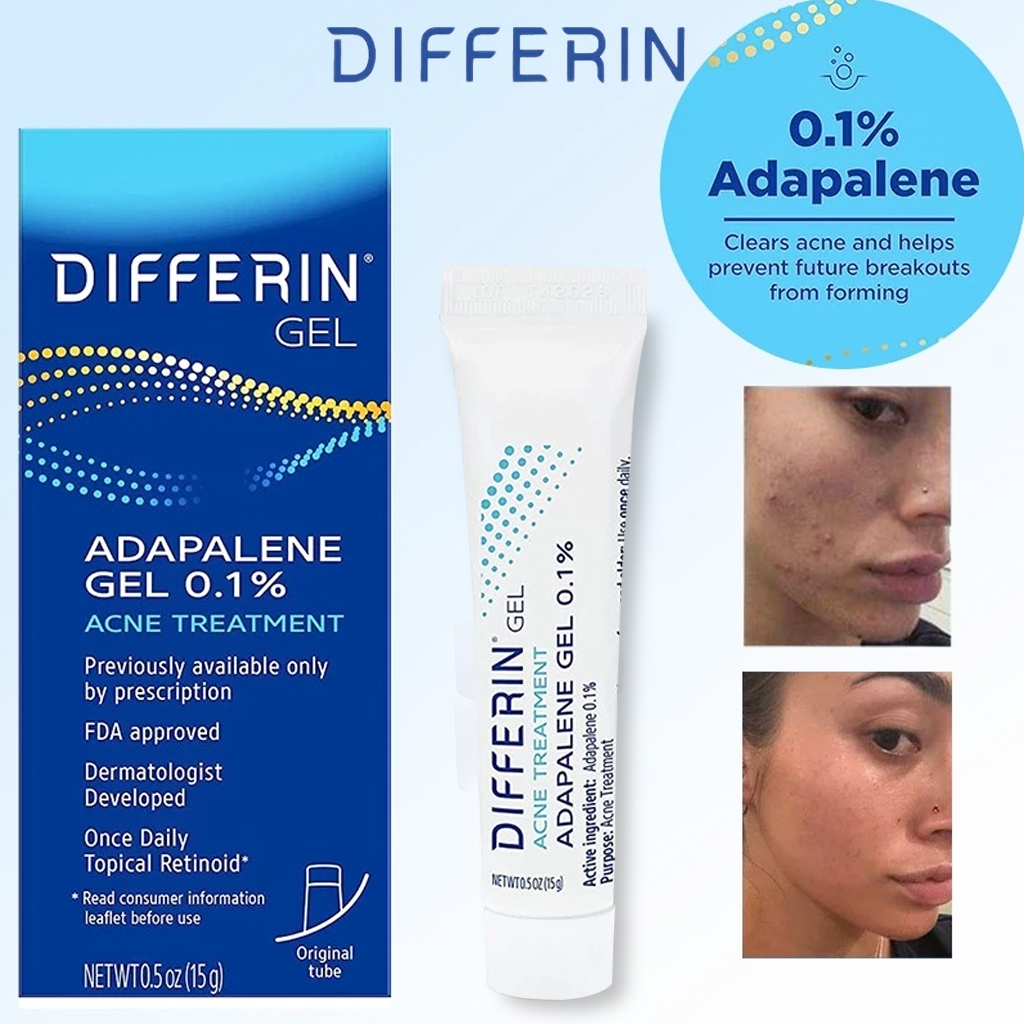 Differin adapalene gel 0.1% acne treatment 15g /Adapalene Adapalen Gel 0.1% / Acne Treatment