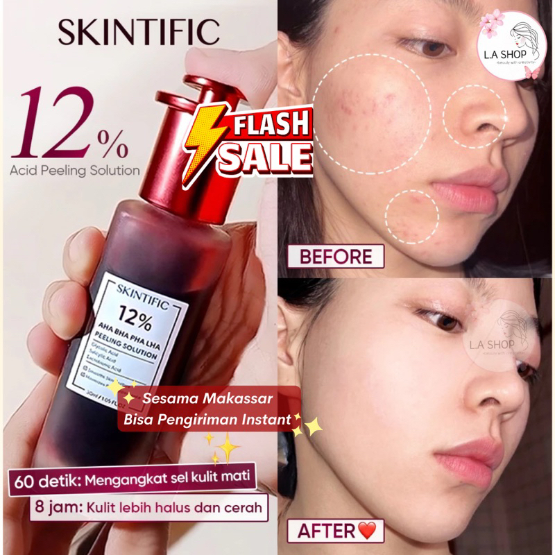 SKINTIFIC Peeling Serum 12% AHA BHA PHA Serum 30ml  - SKINTIFIC Makassar [ReadySiapKirim]