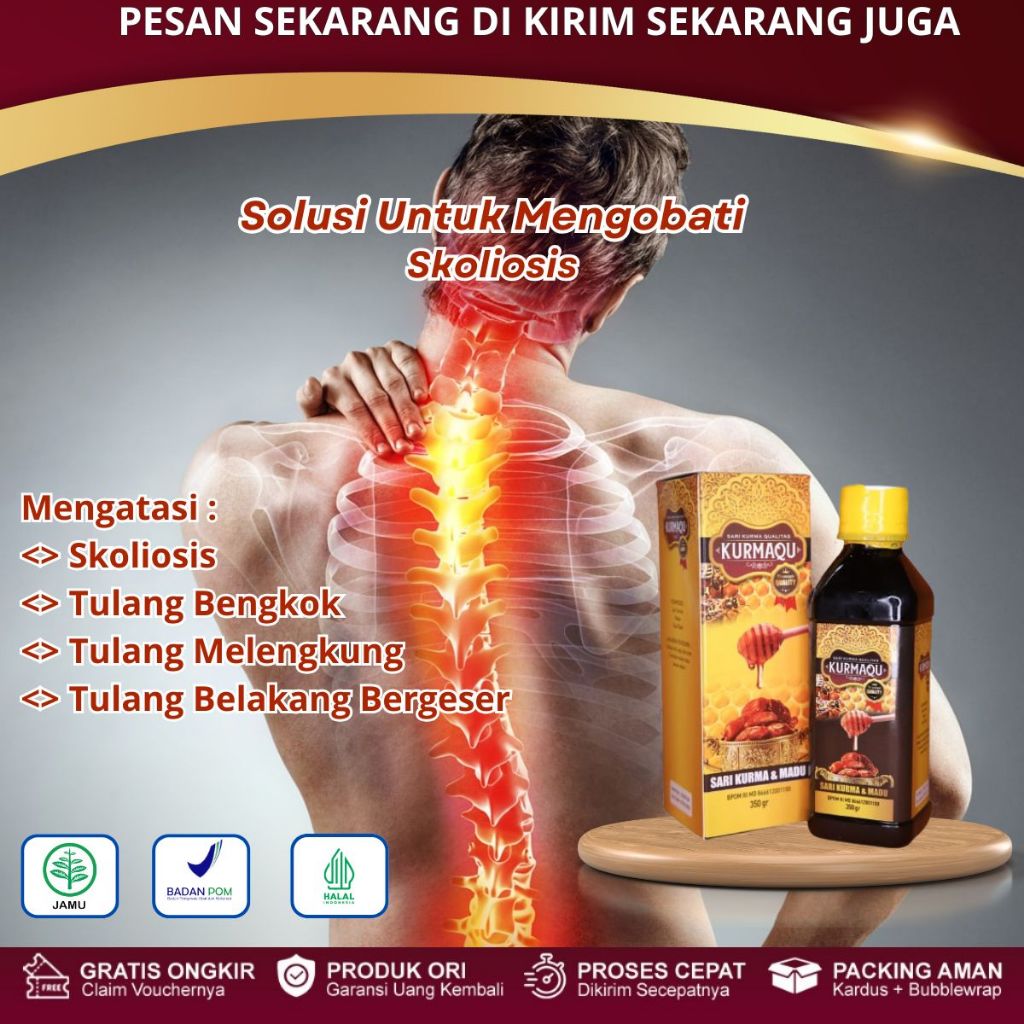 Kurmaqu - Obat Skoliosis Pelurus Tulang Bengkok, Tulang Punggung Bengkok, Gangguan Tulang Belakang