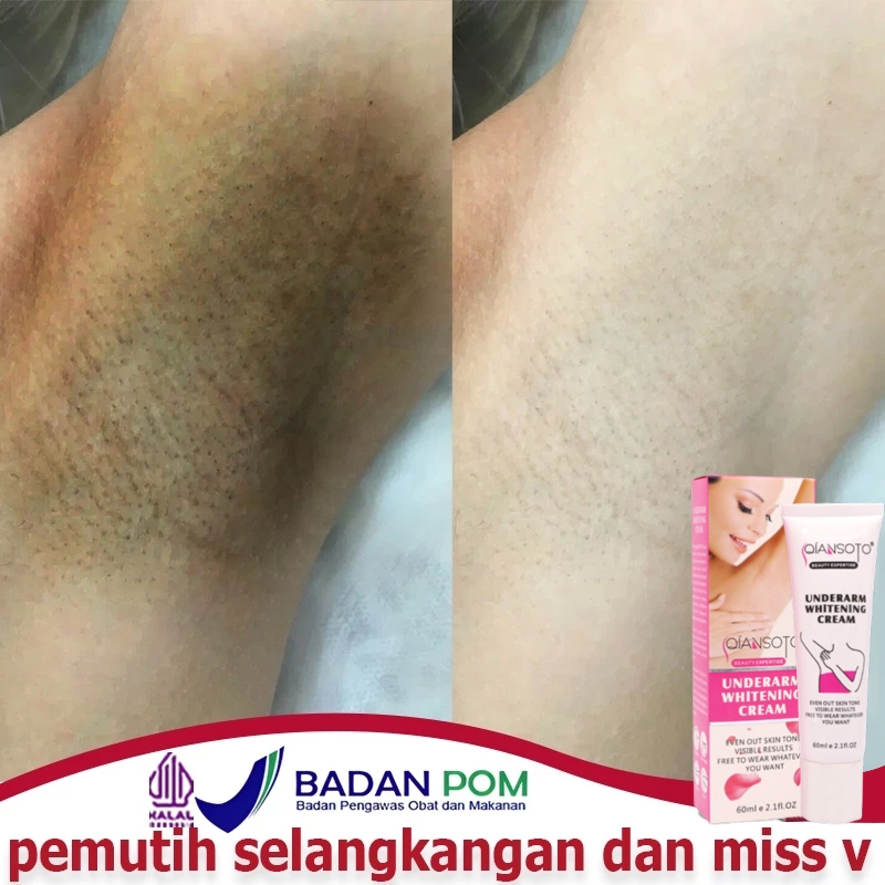 Pemutih selangkangan Pemutih ketiak Krim pemutih Pemutih tubuh Underarm Whitening cream Perawatan ke
