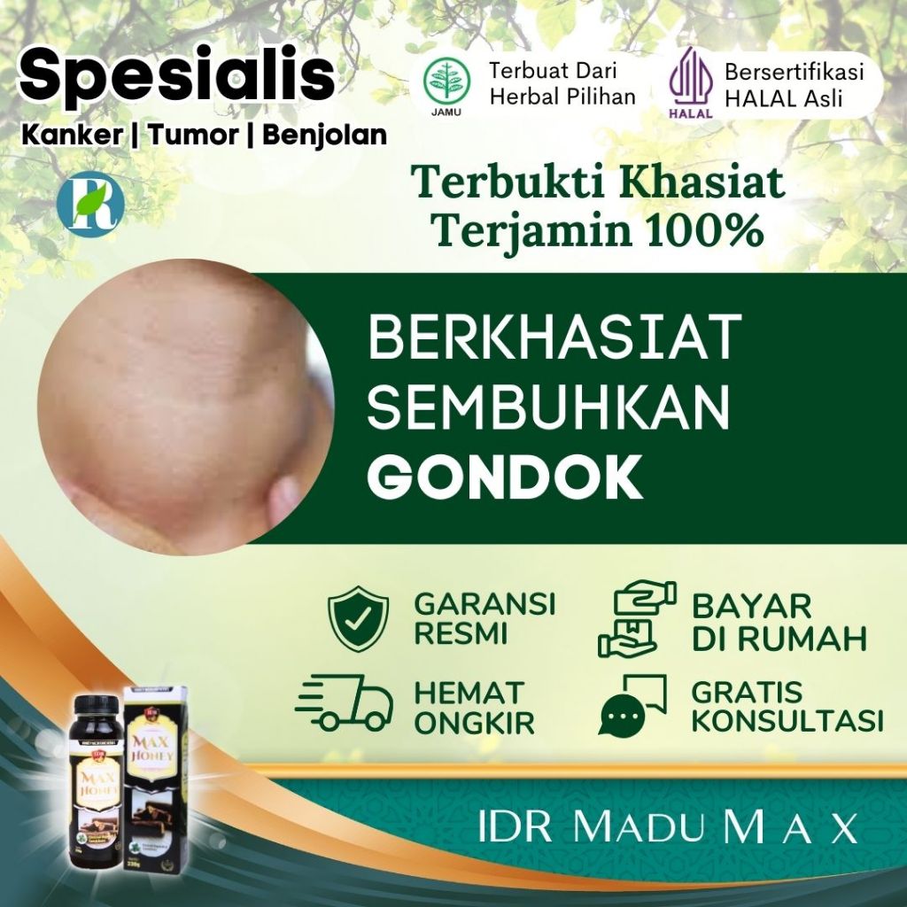 Obat Herbal Alami Pengobatan Gondok- IDR Madu Max - Terbukti Berdasarkan Testimoni 100%