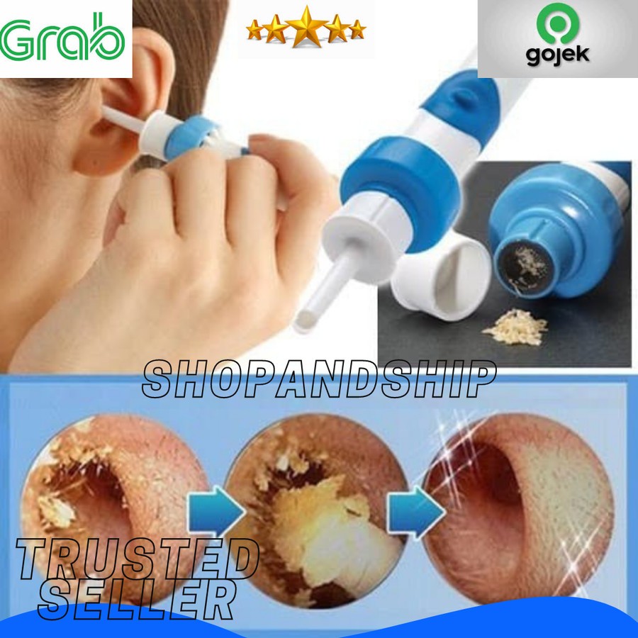 I-EAR Alat Pembersih Sedot Kotoran Kuping Telinga Bertekhnologi