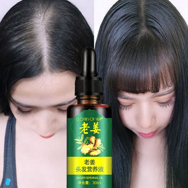Promo Bulan Ini  OBAT PENUMBUH RAMBUT BOTAK SERUM PENUMBUH RAMBUT KEPALA