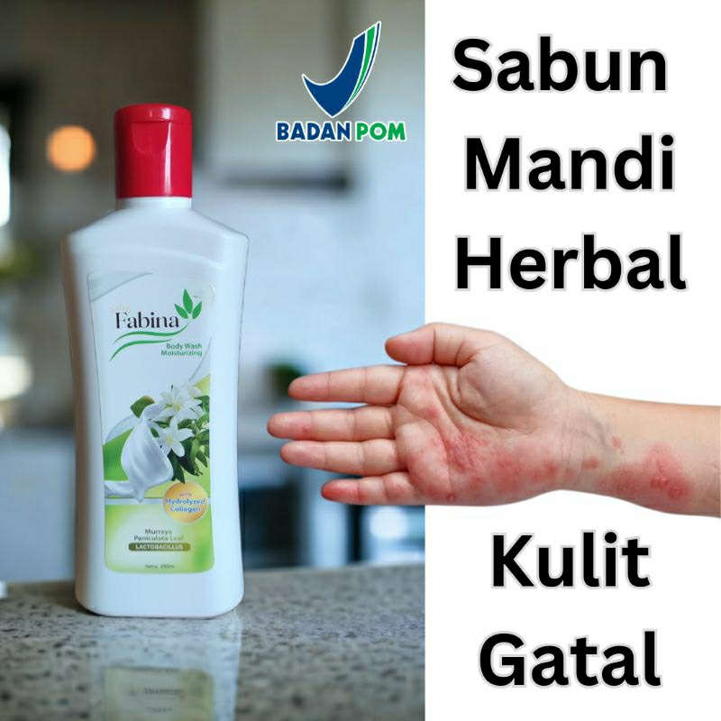 Fabina Sabun Mandi Herbal Untuk Kulit Gatal-Gatal