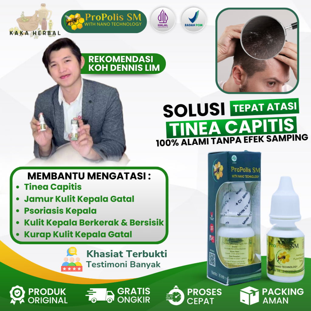 Propolis SM - Obat Jamur Kepala & Tinea Kapitis | Obat Kulit Kepala Gatal, Berkerak, Bersisik
