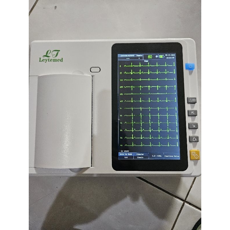ecg 3 channel interpretasi