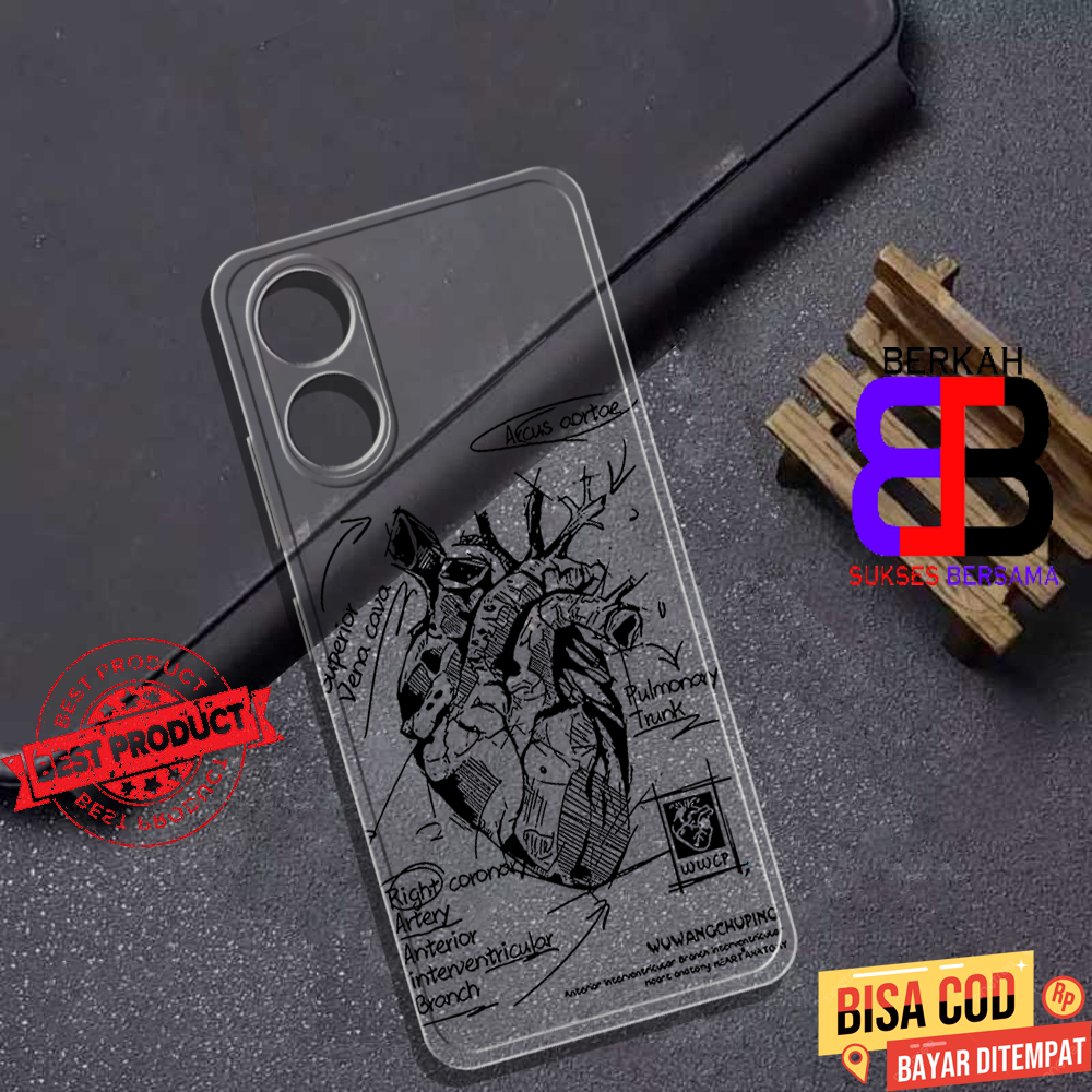 Soft Case Clear Opoo A17 - Casing Oppo A98 Terbaru Berkah Sukses [ ART ] Silikon Hp Oppo A18 - Case 