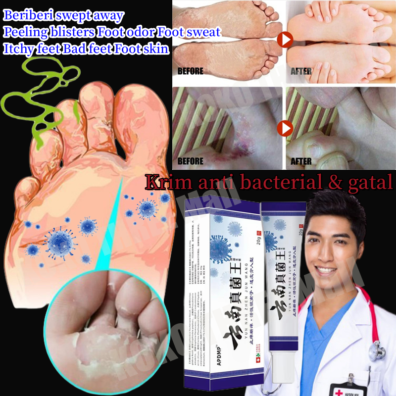 Obat Kaki Rayapan Dan Bau Salep Kaki Rayapan Obat Gatal Penghilang Bau Kaki Krim Pengelupas Kulit Ma