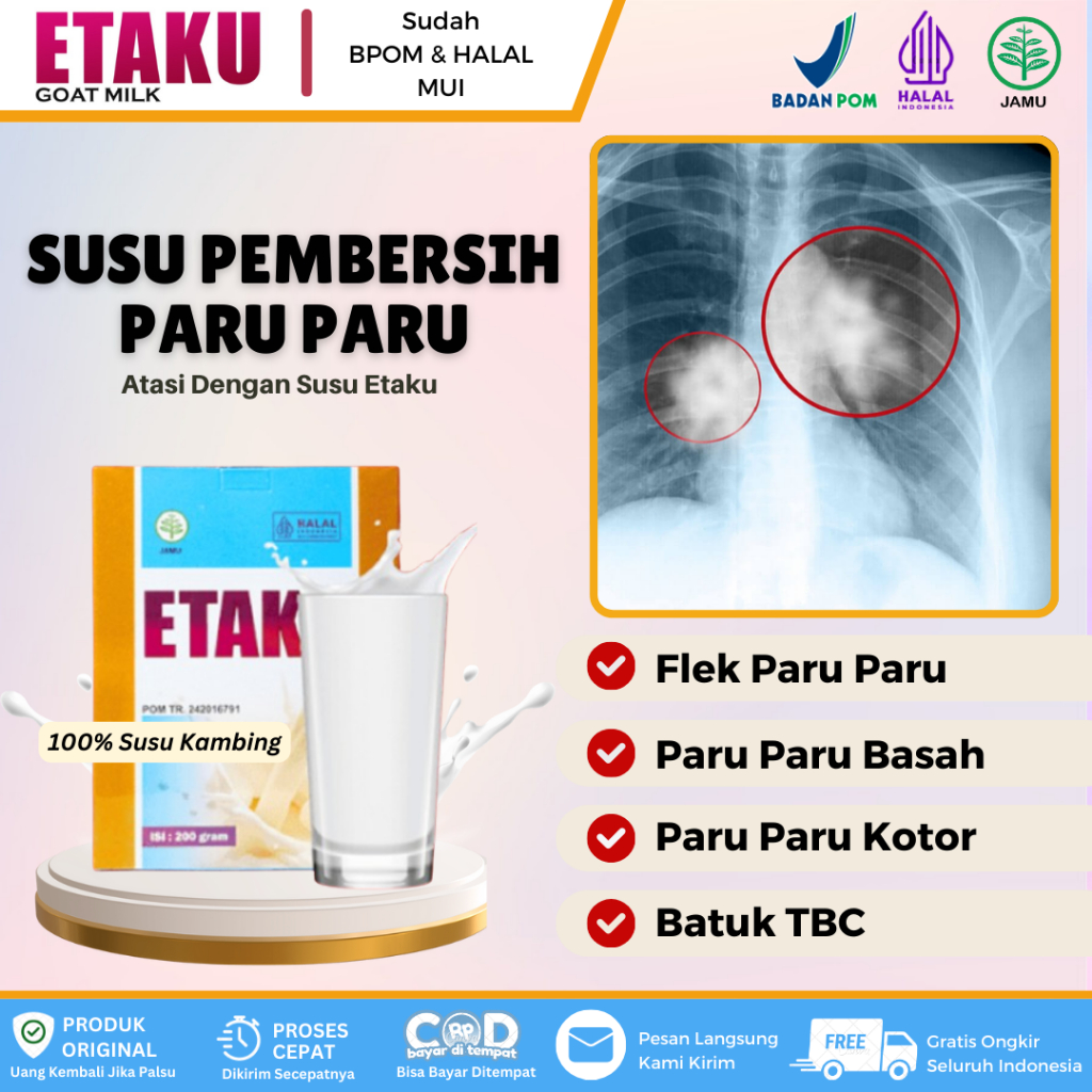 

Susu Etaku - Susu Pembersih Paru - Paru, Flek Paru, Bronkitis, Paru Paru Kotor, Batuk TBC, Asma Atasi Dengan Susu Kambing Etaku HALAL BPOM