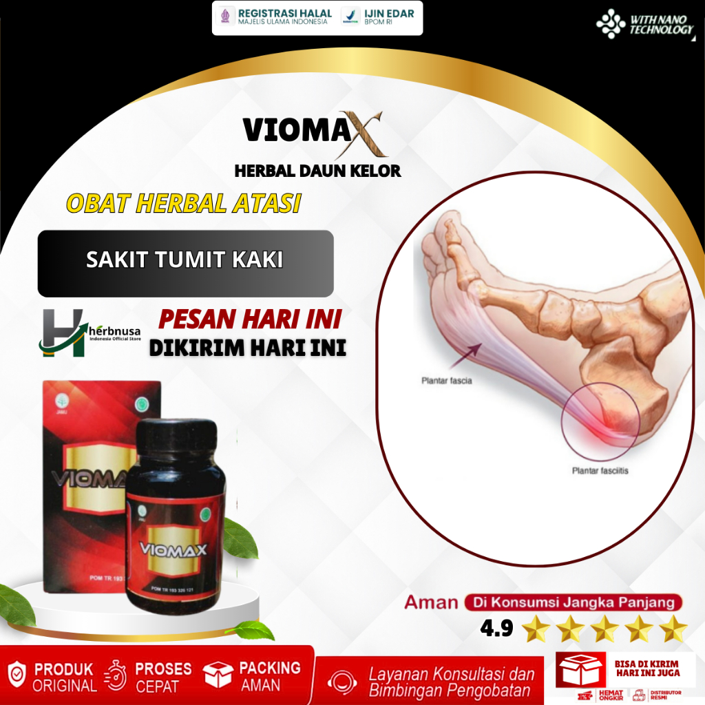 Obat Sakit Tumit Kaki Nyeri Tumit Kaki Plantar Fasciitis Taji Tulang Nyeri Telapak Kaki Radang Tumit