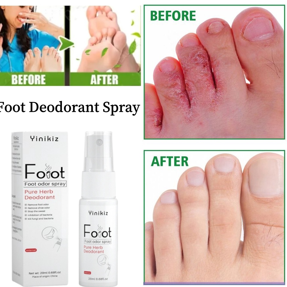 Foot Spray Penghilang Bau Kaki Penghilang Bau Kaki Dan Sepatu Menghilangkan Bau Kaki Penghilang Bau 