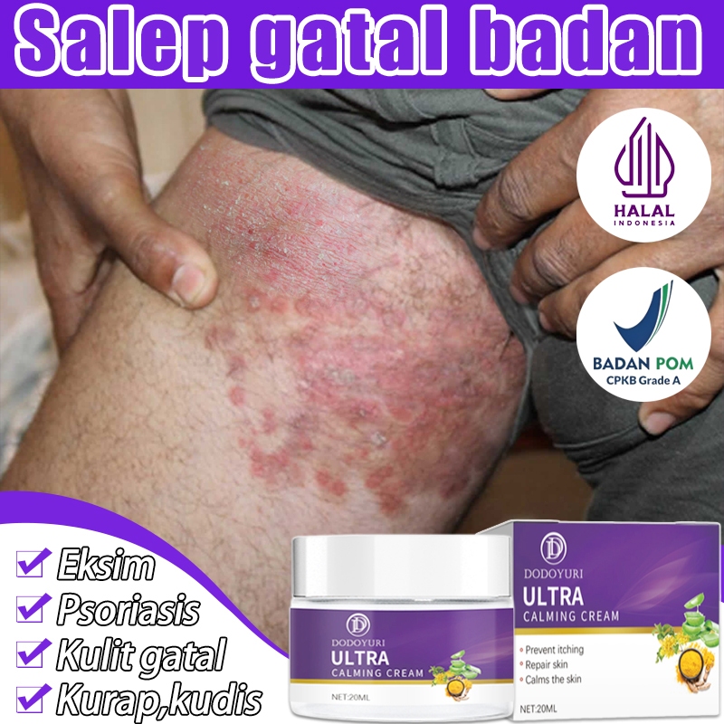 Obat gatal selangkangan salep gatal kulit salep gatal selangkangan 20g salep gatal china paling ampu