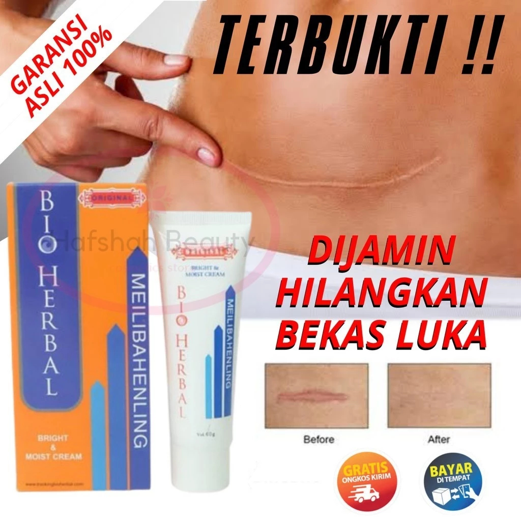 Penghilang Bekas Luka Koreng Cacar Air Kudis Kurap Gigitan Nyamuk Meilibahenling Bio Herbal