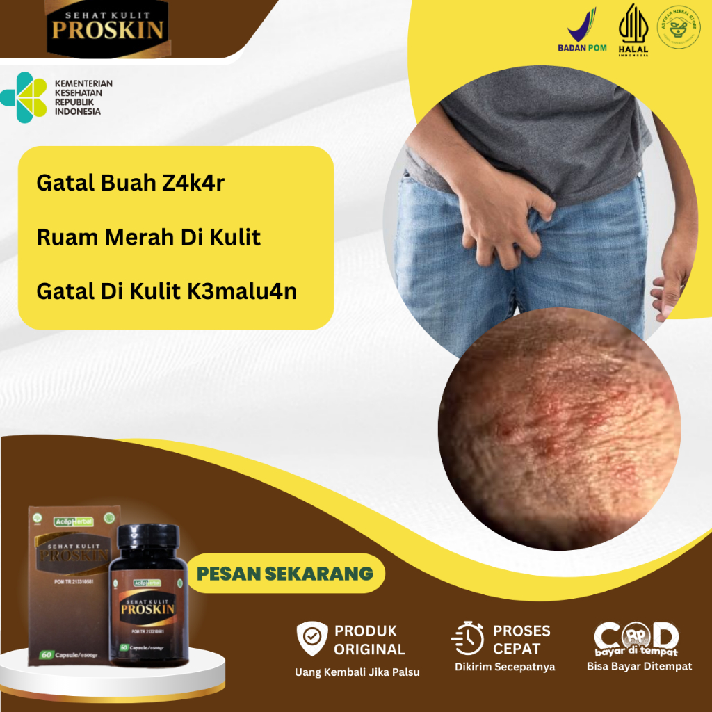 Obat Gatal Buah Zakar, Obat Gatal Kelamin, Obat Gatal Kulit Buah Zakar, Obat Gatal Penis, Obat Pengh