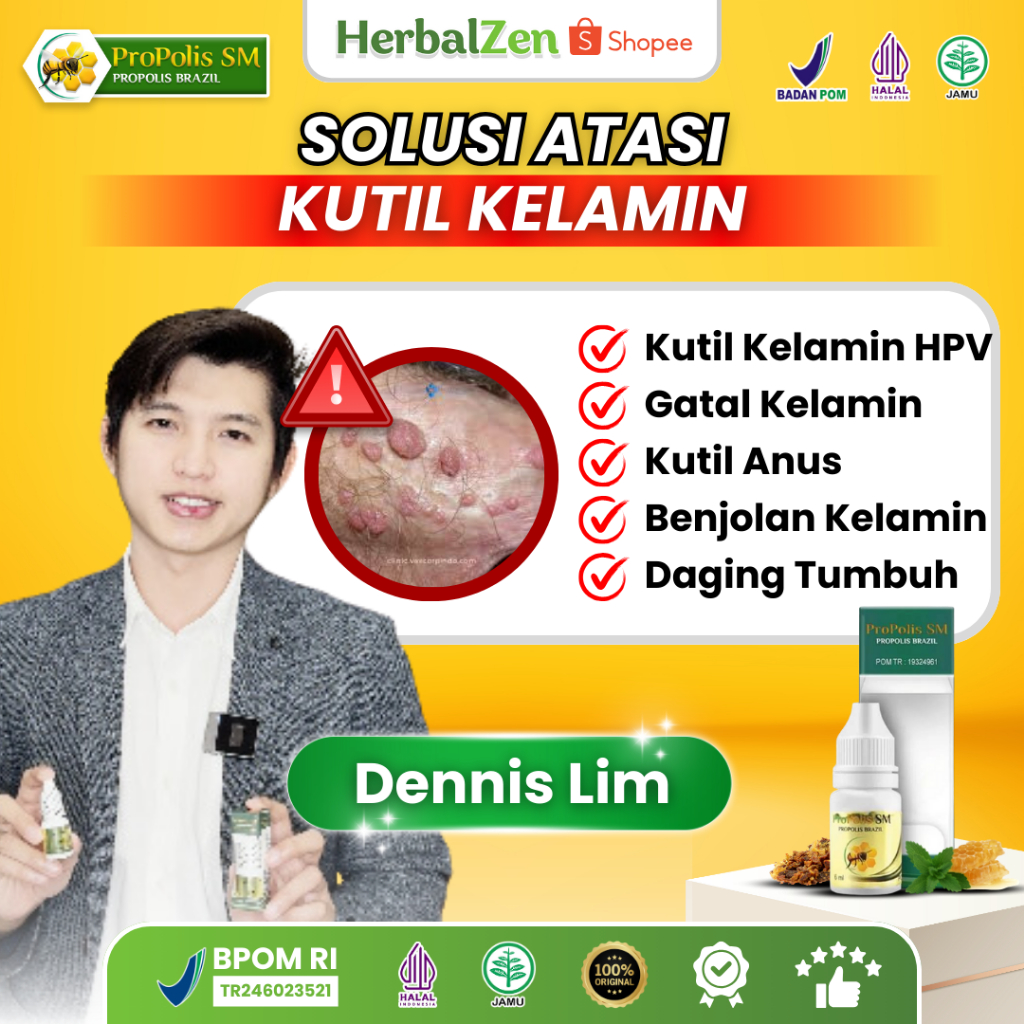 Obat Kutil Kelamin HPV, Obat Kutil Anus Pria / Wanita, Perontok Kutil Kelamin Alami, Obat Kutil Kela