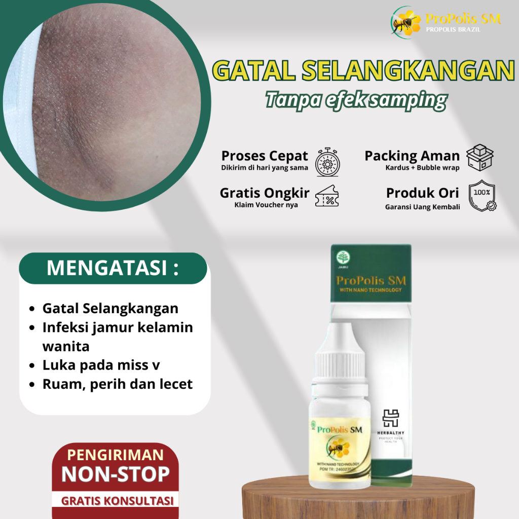 Obat Gatal Selangkangan Gatel Kulit Infeksi Jamur Obat Gatal Selangkangan Babak Selangkangan Jamuran