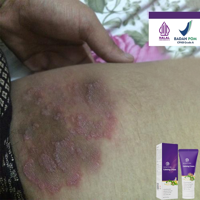 Salep gatal salep gatal china paling ampuh obat gatal salep gatal jamur selangkangan 20g salep china
