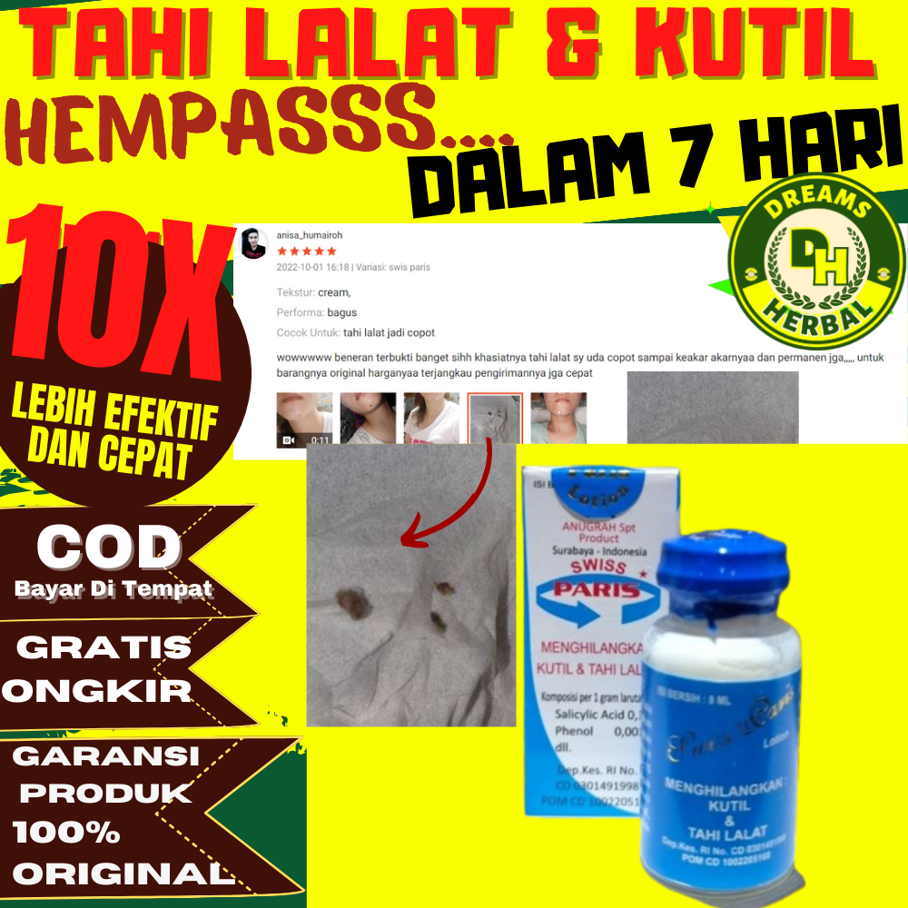 Swiss Swis Paris Lotion 100% Asli Original Obat Cream Krim Salep Penghilang Menghilangkan Pencabut T