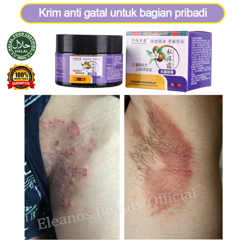 Obat gatal kulit obat alergi gatal kulit salap gatal selangkanga salep selangkangan gatal dan hitam 