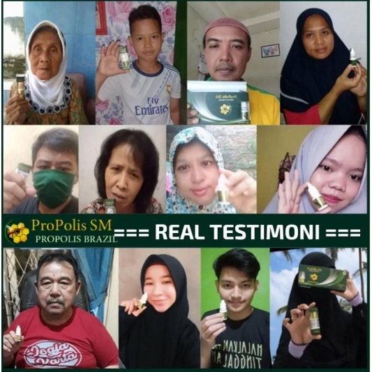 Obat Penghilang Ketombe Berlebihan, Ketombe Parah, Ketombe Berkerak, Obat Ketombe, Obat Tetes Ketomb