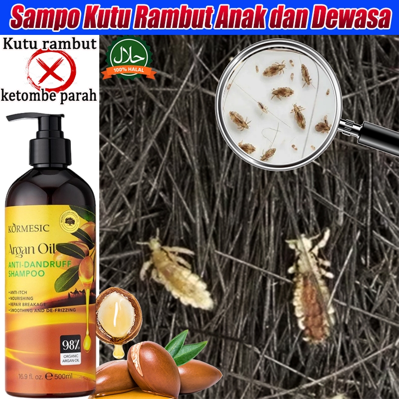 Shampo Kutu rambut Anak dan Dewasa 500ml shampoo kutu rambut shampoo anti ketombe dan rontok