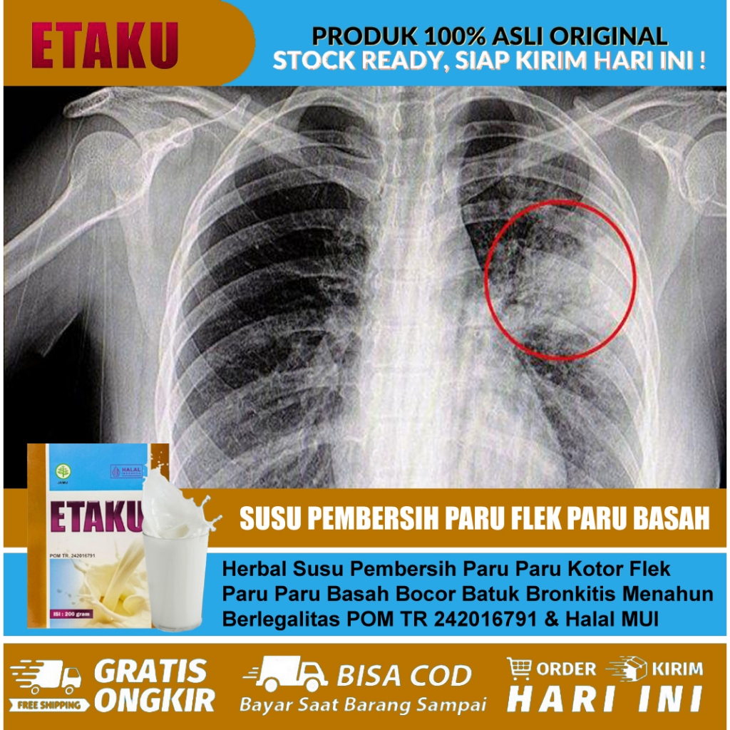 

Susu Pembersih Paru Paru Kotor Flek Paru Basah Batuk Berdahak Bronkitis - ETAKU Asli Original BPOM Halal