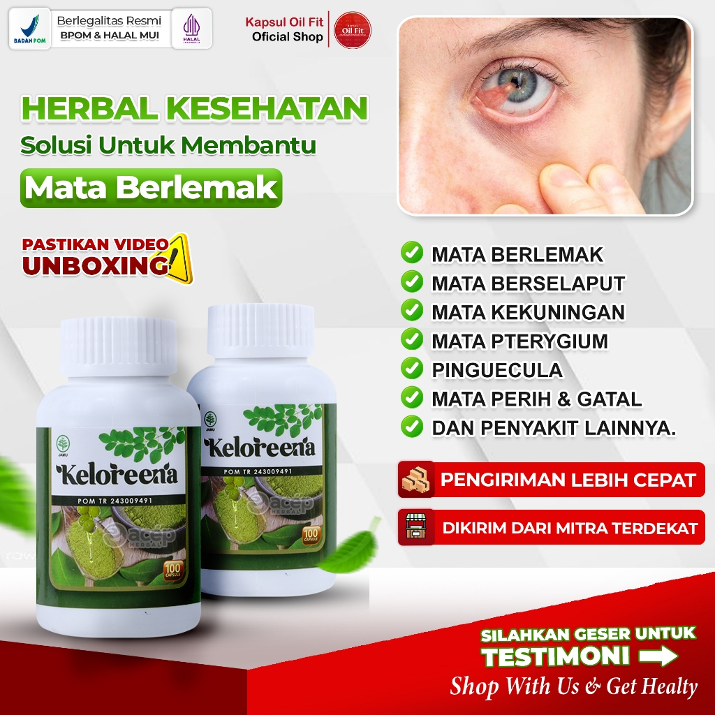 Obat Mata Berlemak Mata Kekuningan Berbelek Berselaput Pterigium Ada Selaput di Bagian Putih Bola Ma