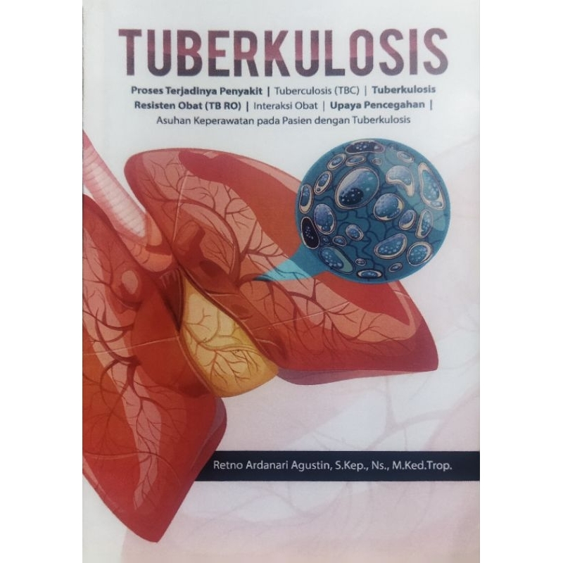 buku tuberkulosis