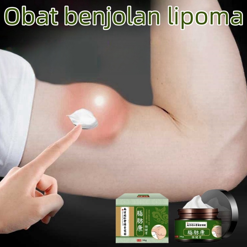 Obat benjolan lipoma cream salep lipoma salep benjolan obat benjolan di leher salep penghilang