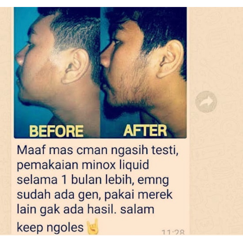 TERMURAH TERLARIS KEMASAN BARU NEW PACK MINOXIDIL MADE IN ISRAEL COTSCO USA CANADA NORVINE PENUMBUH 