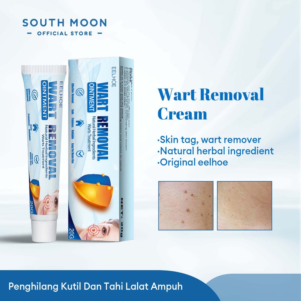 EELHOE Salep Penghilang Kutil 20g Salep Kutil Ampuh Kutil Remover Alat Penghilang Kutil Penghilang K