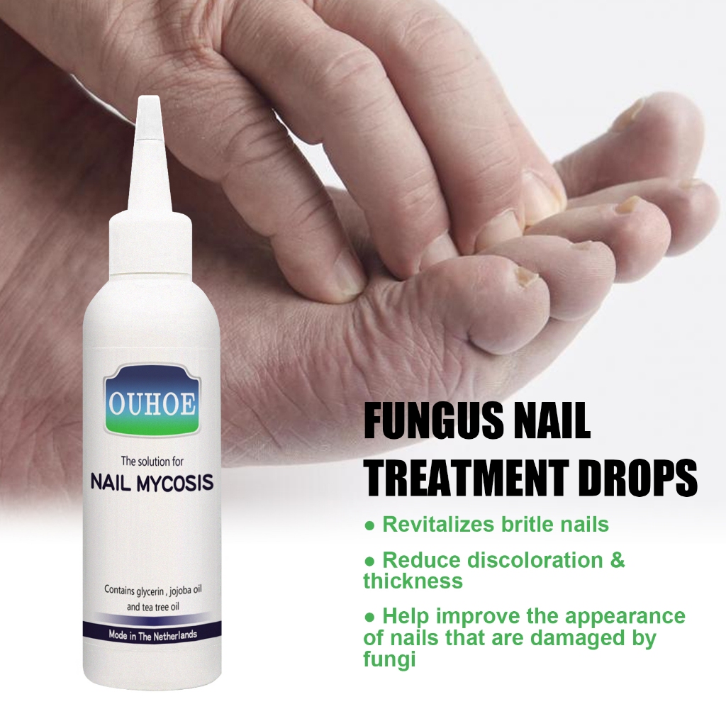 OUHOE Obat Tetes Perbaikan Kuku Jamur 75ml Contains Glycerin Jojoba Oil And Tea Tree Oil Mode In The