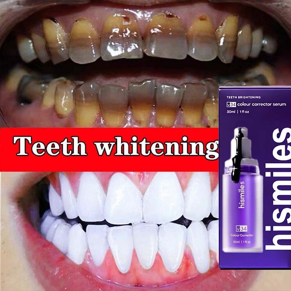 Pemutih gigi kuning dan karang/Pembersih karang gigi ​pasta gigi /perontok karang gigi/pembersih kar