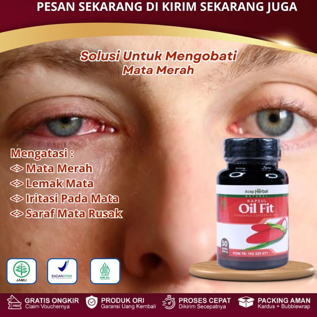 Kapsul Oil Fit - Obat Mata Merah, Obat Mata Iritasi, Mata Bengkak Berair, Mata Buram, Glaukoma