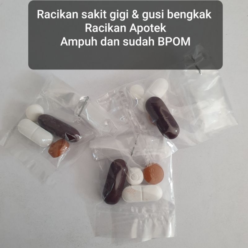 Racikan sakit gigi dan gusi bengkak