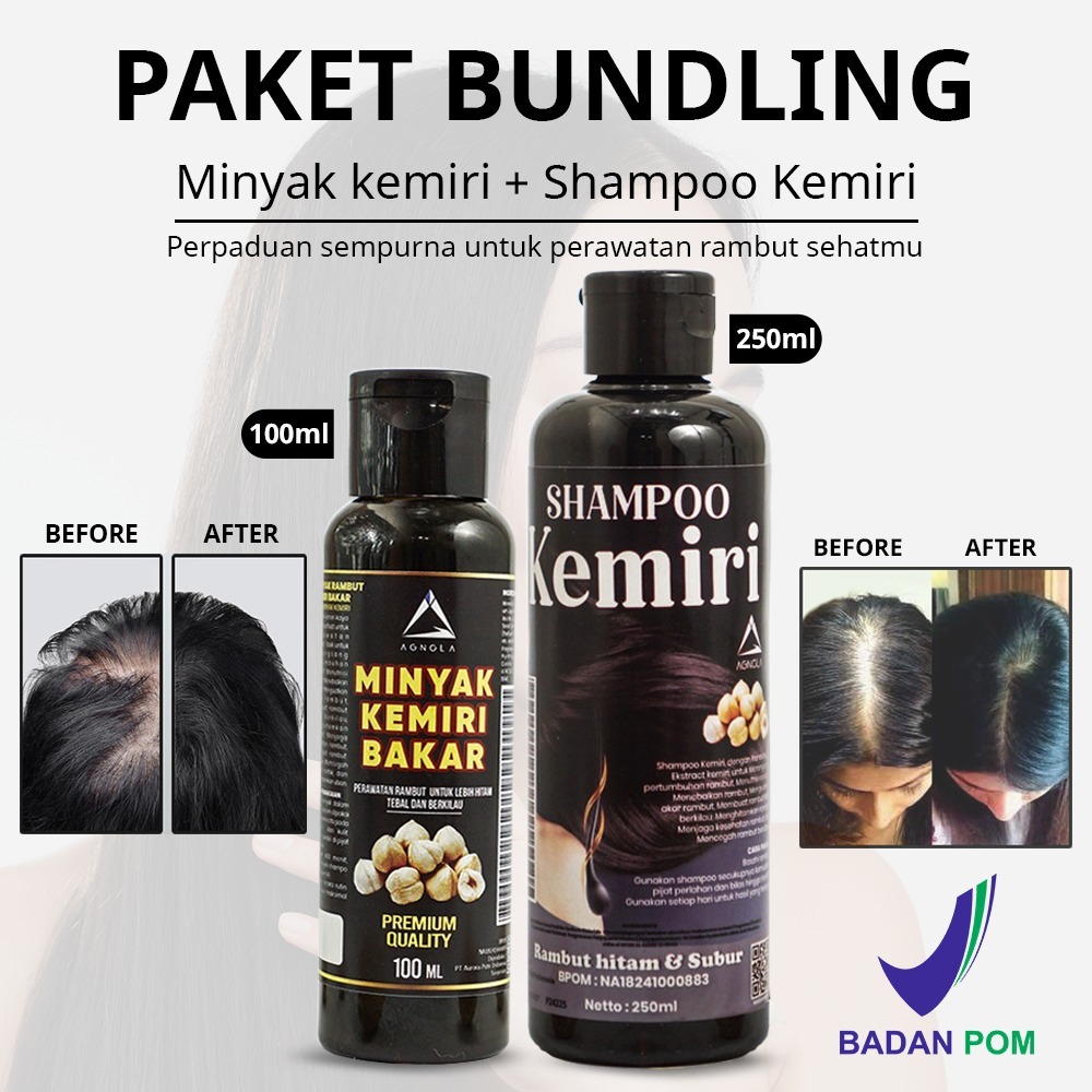 Paket 2in1 Shampoo Kemiri 250ml & Minyak Kemiri 100ml Penumbuh Rambut Cepat Penghilang Uban Dan Ront