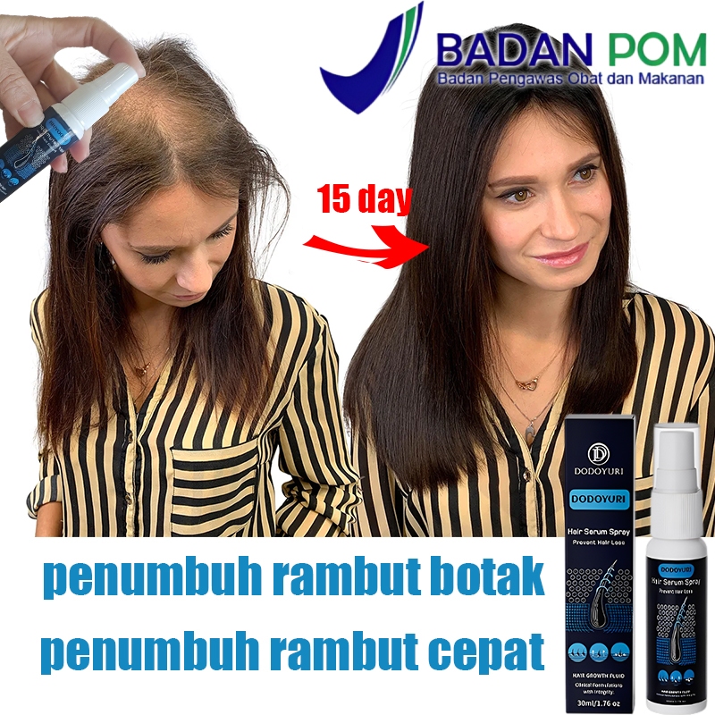 Penumbuh rambut botak Serum penumbuh rambut Obat penumbuh rambut Penumbuh rambut cepat 30ml Penumbuh