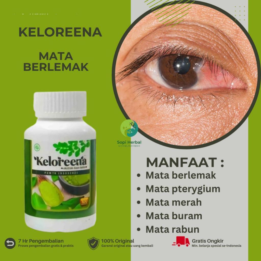Keloreena - Mata Berlemak, Mata Katarak, Mata Minus, Mata Silinder
