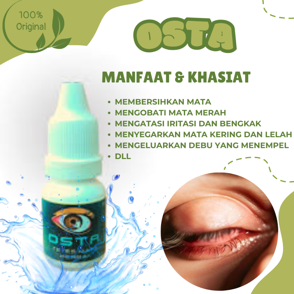 Sulit Membuka Mata Saat Bangun Tidur, Mata Terasa Gatal, Kelopak Mata Membengkak | Ampuh Dengan OSTA