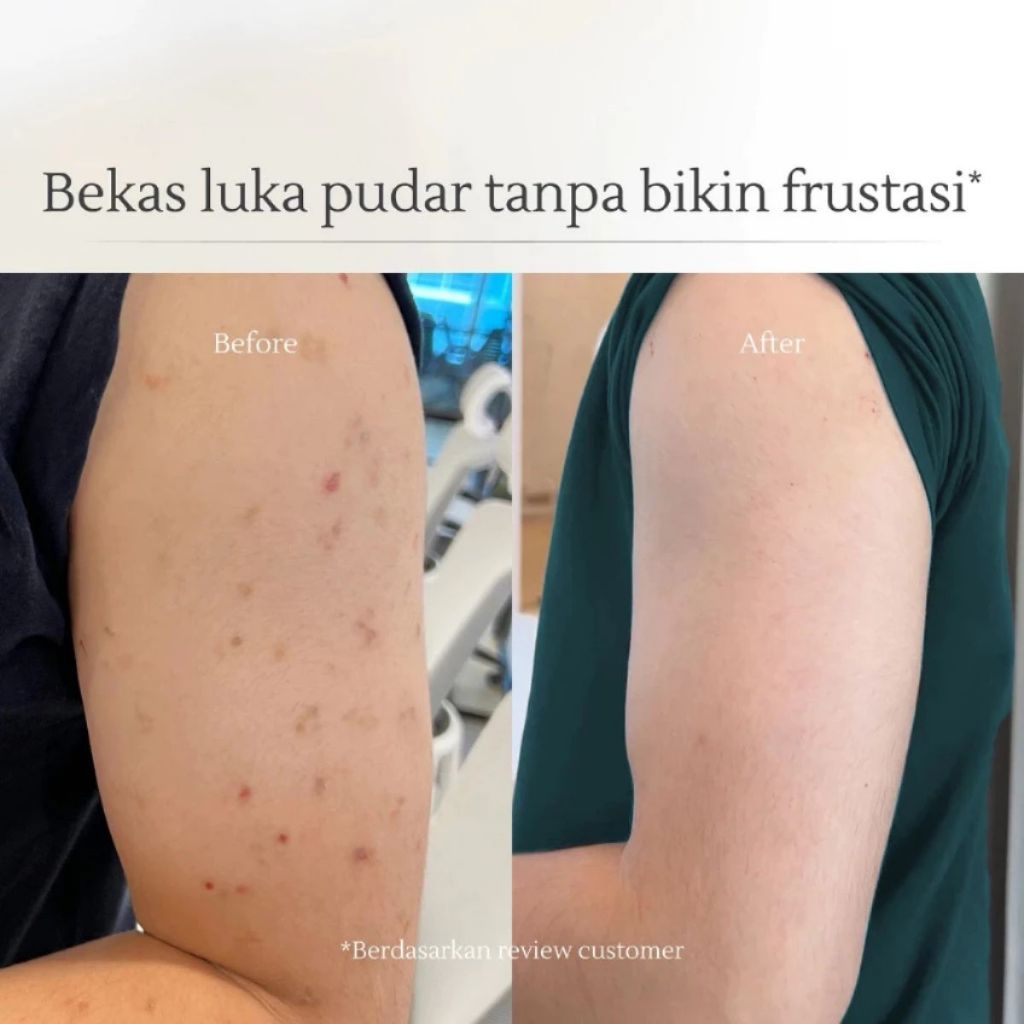 ByuSa DISKON TERMURAH !! EVOKE Body Wash - Coastal Journey Sabun Untuk Menghilangkan Bekas Luka Atau