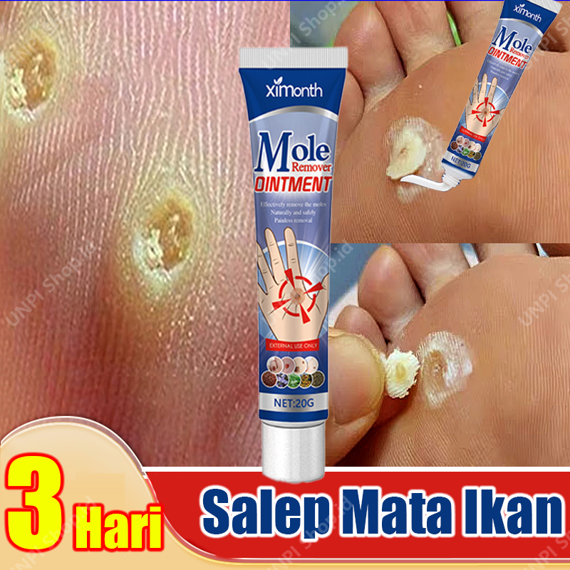 RB6 Salep Mata Ikan Ampuh Obat Mata Ikan Kaki Penghilang Mata Ikan Obat Penghilang Kutil Dan Tahi