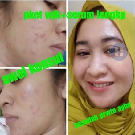 Serum Whitening Aybe Skincare