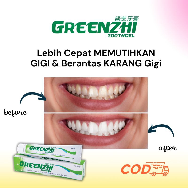 Greenzhi Toothgel Shuang Hor Pasta Gigi Pemutih